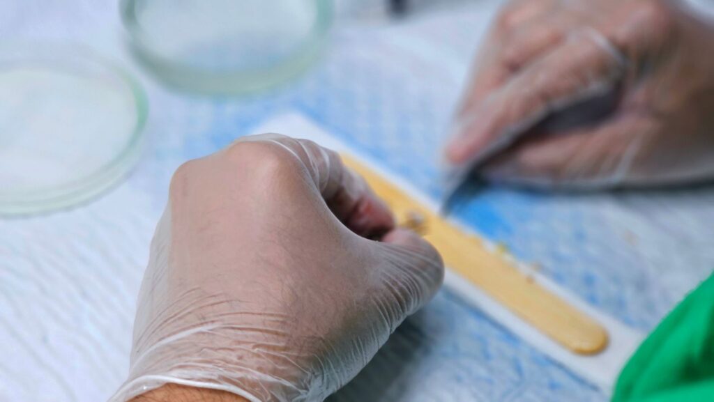 Hair graft preparation during surgery